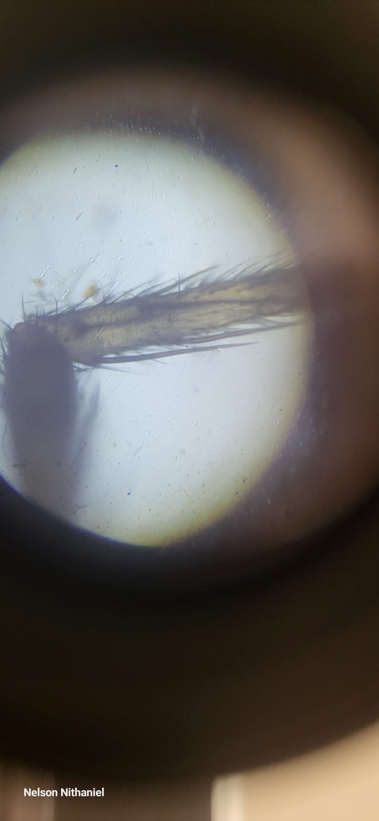 Wings, Legs and Lenses: Grade 10's Pooter Insect Investigation at bms