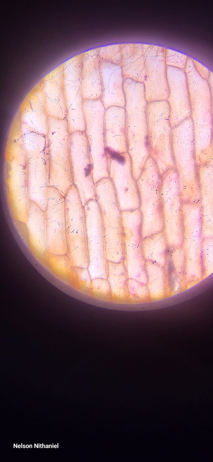 A Tiny Window into the World of Cells: Grade 6's Onion Peel Experiment at bms